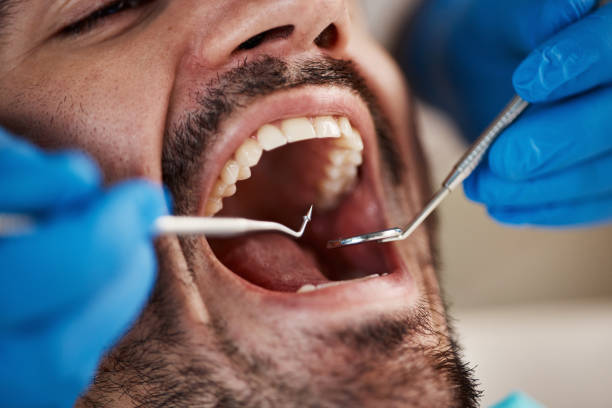 Emergency Dentist Open Today in GA